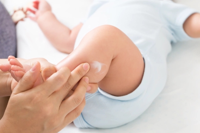 Cảnh báo dưỡng ẩm cho bé có thể làm tăng nguy cơ mắc chứng dị ứng